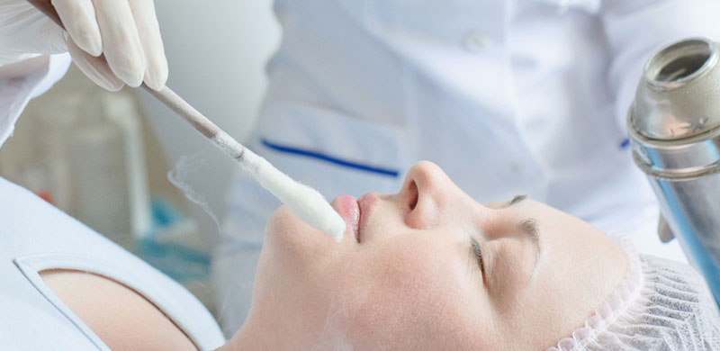 Криотерапия жидким азотом: что это